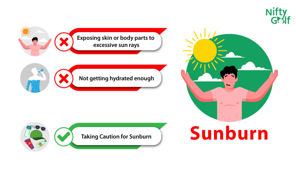 Sunburn